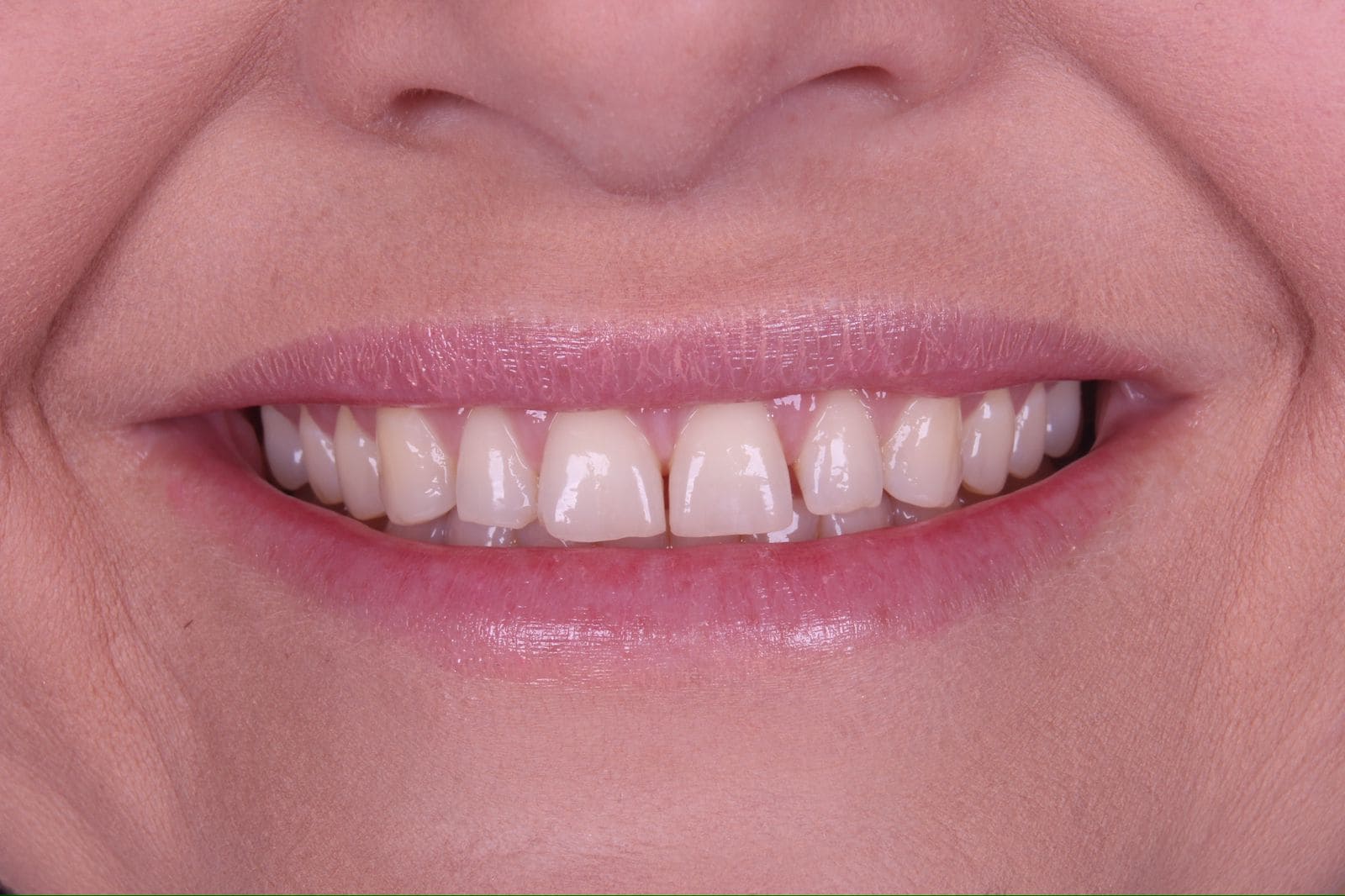 Imagem do WhatsApp de 2024-07-03 à(s) 16.37.14_0460dd79