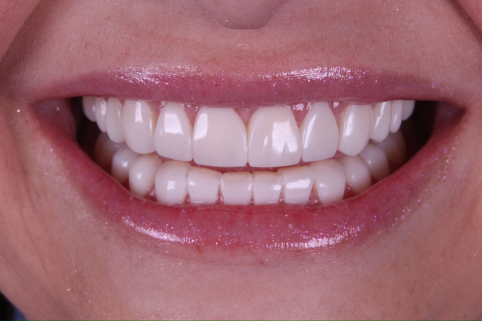 Imagem do WhatsApp de 2024-07-03 à(s) 16.37.15_ec2236cd